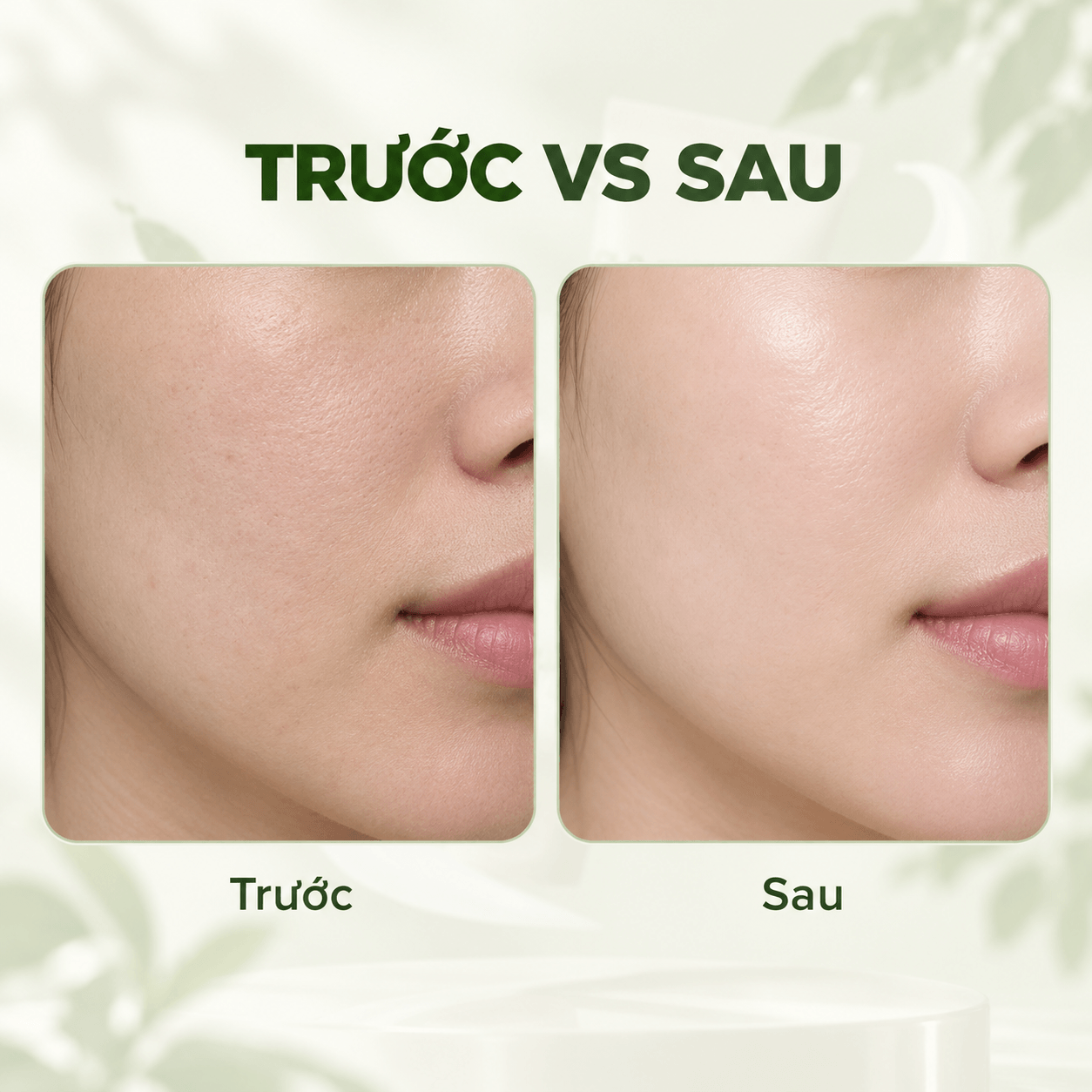Gel tẩy tế bào chết dịu nhẹ Klavuu Phytoncide Peeling Gel