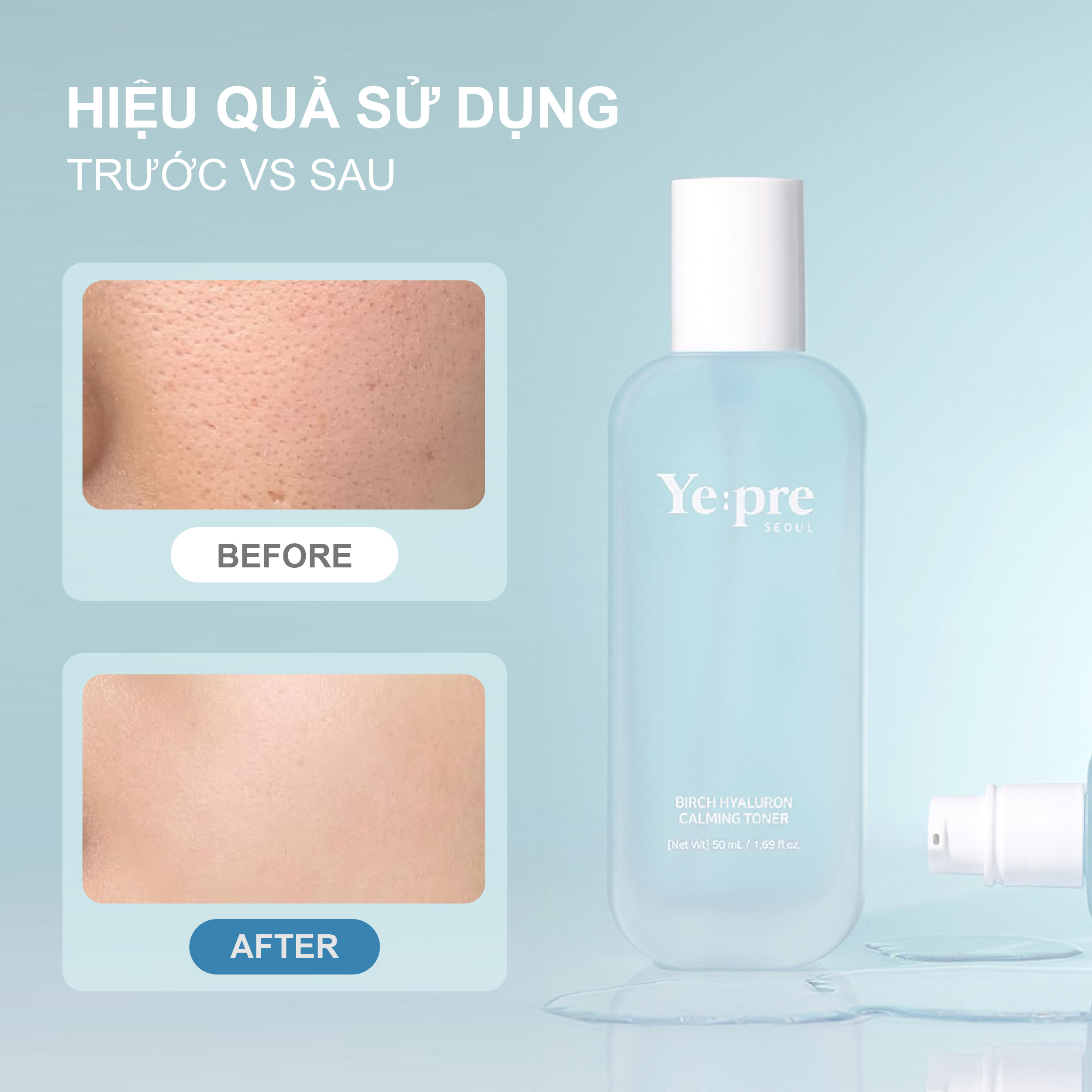 Birch Hyaluron Calming Toner 100ML