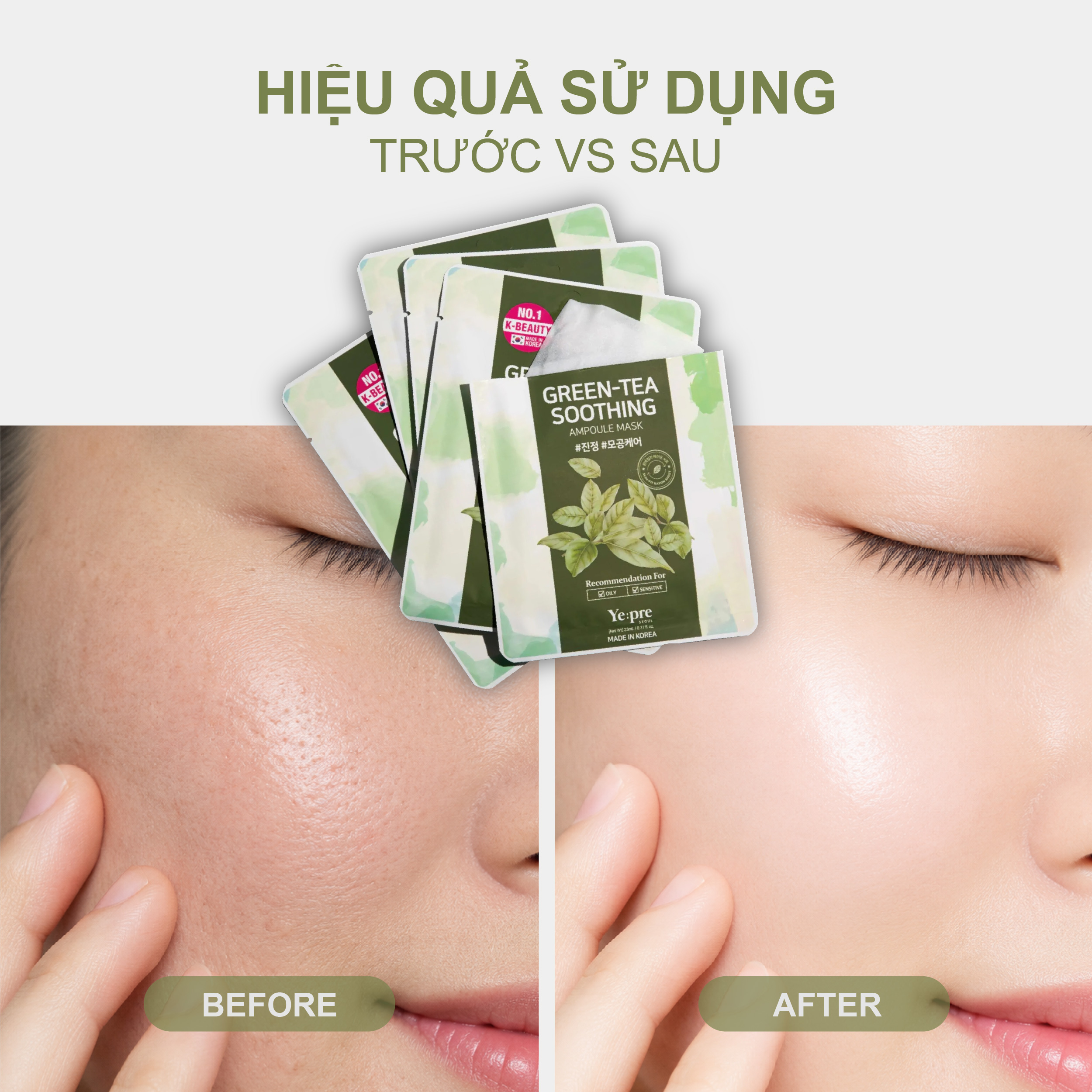 Yepre Green-Tea Soothing Ampoule Mask